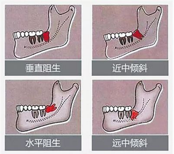 微信截图_20200518165521